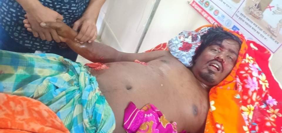 রাজস্থলীতে দুর্বৃত্তের ব্রাশ ফায়ারে যুবক নিহত