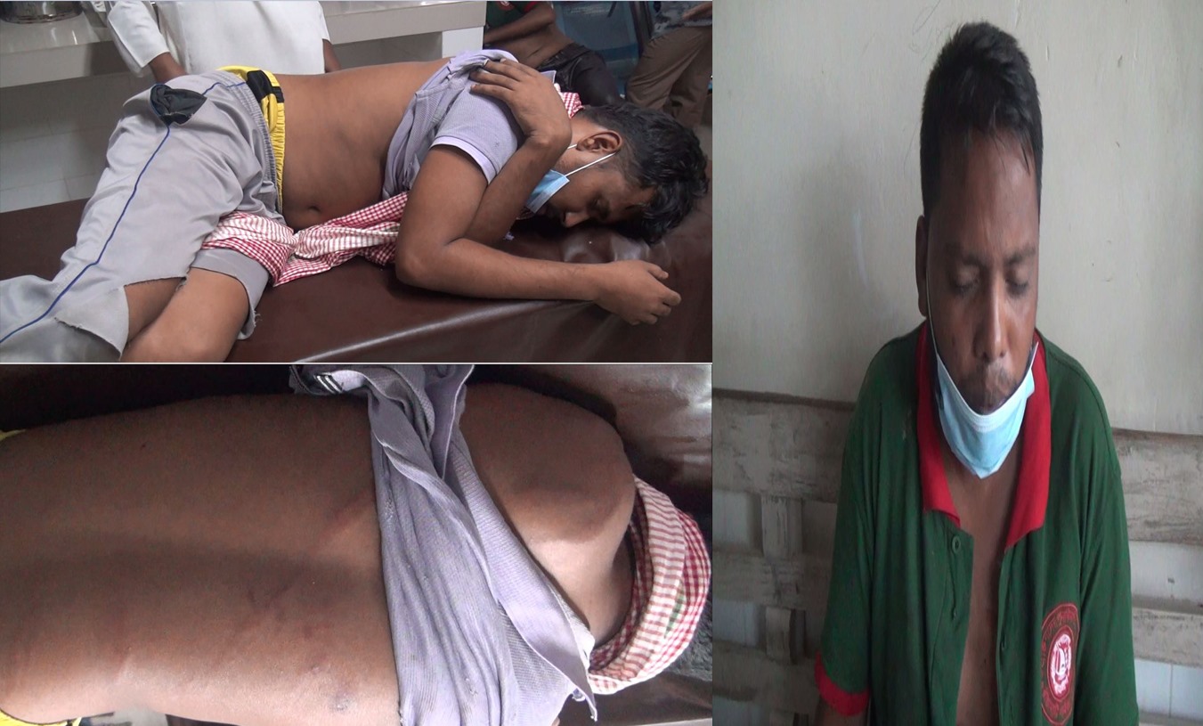 বরকলে প্রতিপক্ষের হামলায় ক্ষমতাসীনদলের দুই নেতা গুরুত্বর আহত: চট্টগ্রামে রেফার্ড