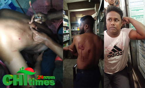 সাজেক থেকে ফেরার পথে সন্ত্রাসীদের গুলিতে দুই ব্যবসায়ী আহত