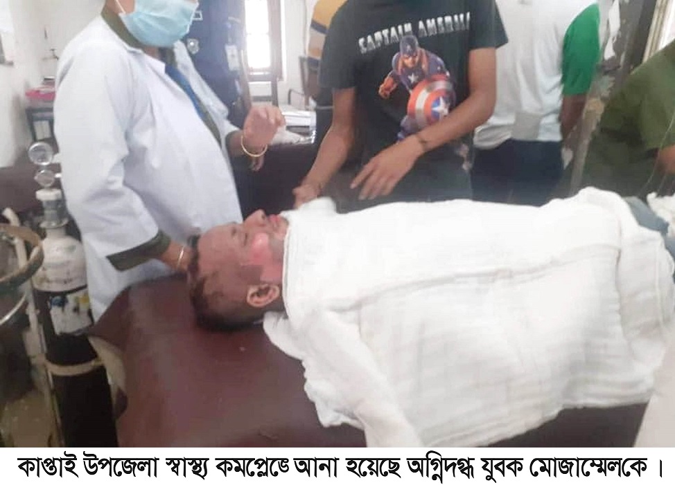 প্রেমে ব্যর্থ হয়ে পেট্রোল ঢেলে আগুন দিয়ে যুবকের আত্মহত্যার চেষ্টা