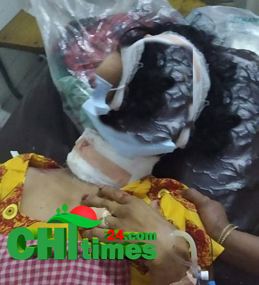 রাজস্থলীতে ধর্ষনের চেষ্টায় ব্যর্থ হয়ে গৃহবধু কে  কুপিয়ে জখম 