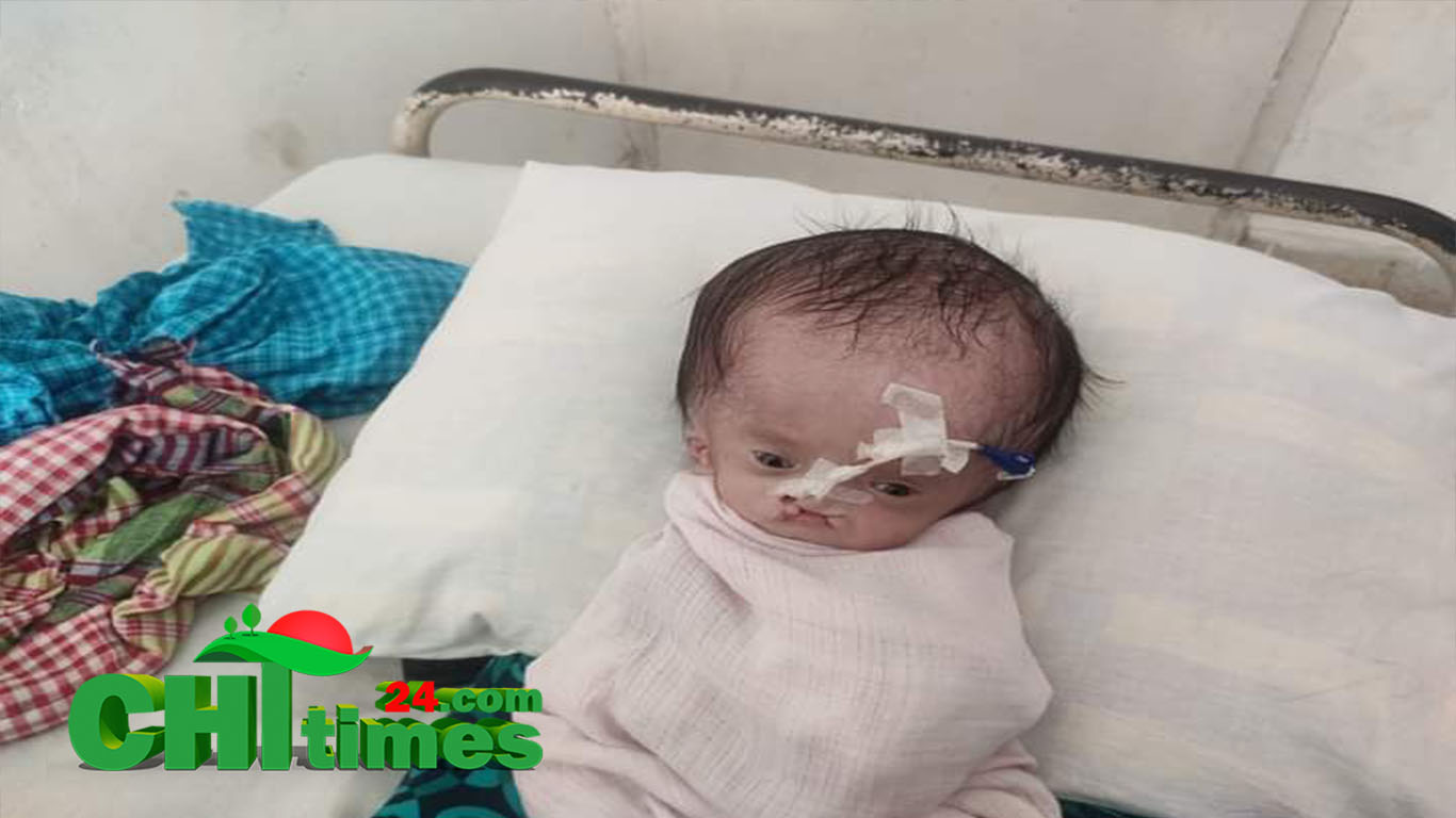 অস্বাভাবিক শিশুর জন্মঃ হাসপাতালে ফেলে চলে গেলো পিতা-মাতা