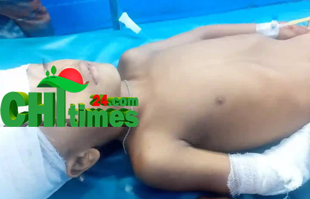 মোটর সাইকেলের ধাক্কায় শিশু আহত 