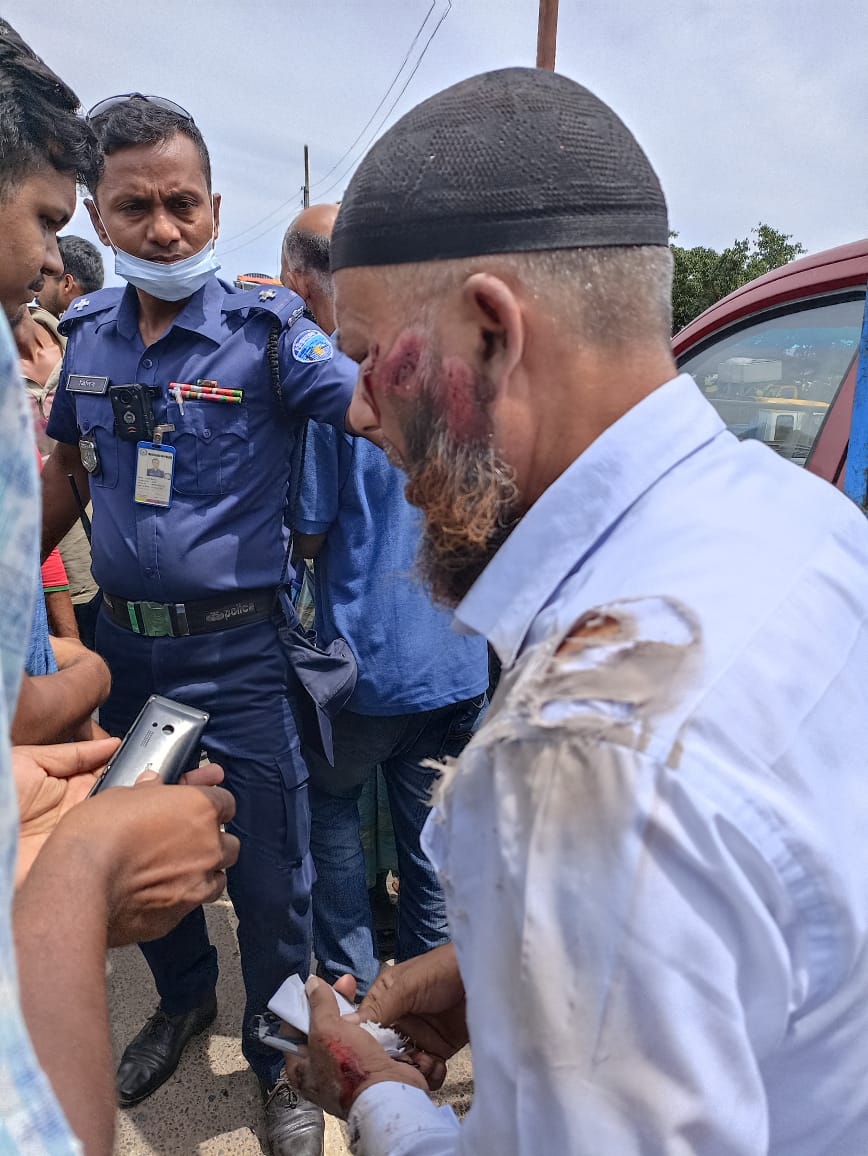 রাঙামাটিতে অটোরিকশা উল্টে  আহত-২