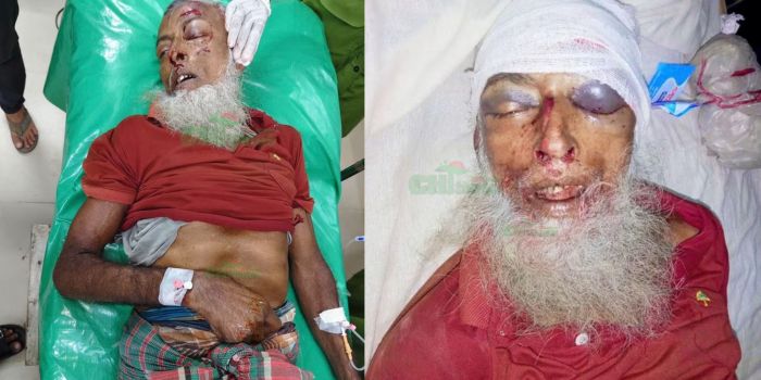 রাঙামাটি শহরে সিএনজি দুর্ঘটনায় প্রাণ গেল বৃদ্ধের,  চালক গ্রেফতার
